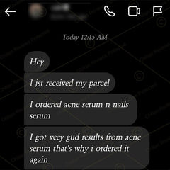Anti – Acne Serum – Brightens Skin, Fades Acne, Lighten Acne Scars & Control Excess Oil Production - Mamasjan
