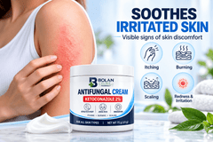 Ketoconazole Cream 2% Antifungal Cream, Relieve Itching, Burning & Flaking Associated with Athlete’s Foot, Ringworm and Jock Itch, Non-Greasy - ChiltanPure