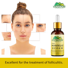 Mandelic Serum - Get Brighter & Luminous Complexion - Mamasjan