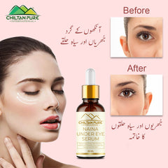 Naina Under Eye Serum – For Firm Delicate Skin, Support firm refreshed look – Reduce fine lines, Dark circles & Puffiness (100% result) - Mamasjan