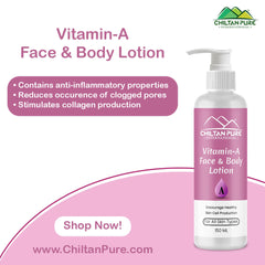 Vitamin-A Lotion - Contains Anti-inflammatory Properties - Helps To Regulate Skin Cells, Reduces Clogged Pores, Stimulates Collagen Production, Reduces The Appearance Of Fine Lines & Wrinkles - Mamasjan