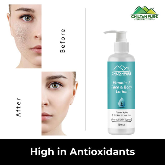 Vitamin-E Lotion - Used as a Moisturizer To Treat or Prevent Dry, Rough, Scaly, Itchy Skin & Minor Skin Irritations (e.g., Diaper rash, Skin Burns From Radiation Therapy) - Mamasjan