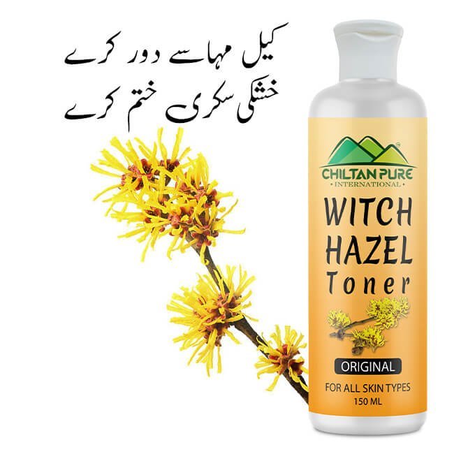 Witch Hazel Toner (Original) – Pore Perfecting Toner, Reduces Inflammation, Soothes Skin & Fights Acne - Mamasjan