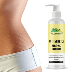 Anti-Stretch Marks Lotion – Formulated To Repair, Diminish & Prevent Stretch Marks With Intense Hydration & Smoothing, Good For Pregnancy Skincare