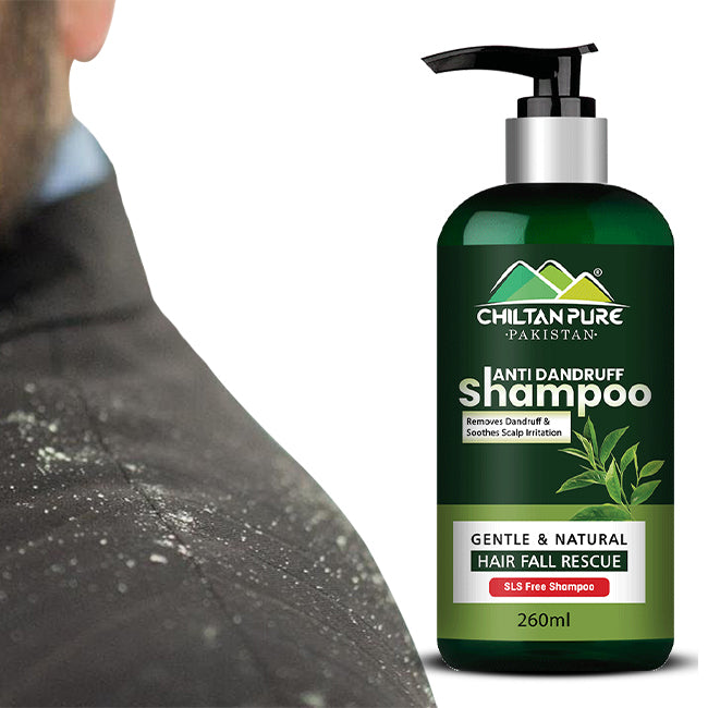 Anti Dandruff Shampoo – Strengthens Hair, Eliminate Wet Dandruff, Soothes Scalp Itching & Contains Anti-Dandruff Properties