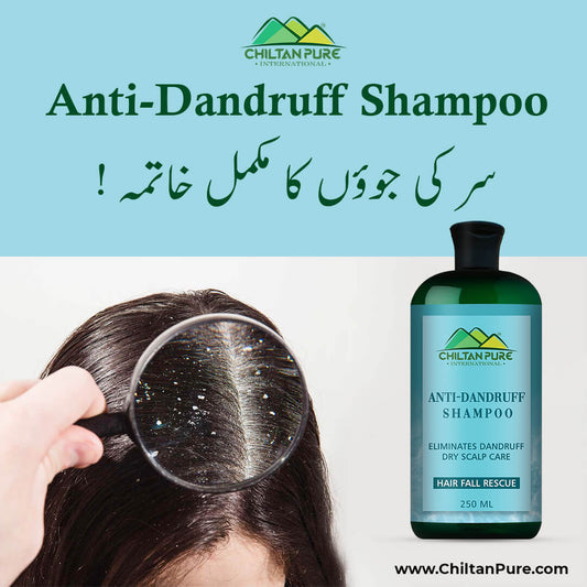 Anti Dandruff Shampoo – Strengthens Hair, Eliminate Wet Dandruff, Soothes Scalp Itching & Contains Anti-Dandruff Properties 250ml - ChiltanPure