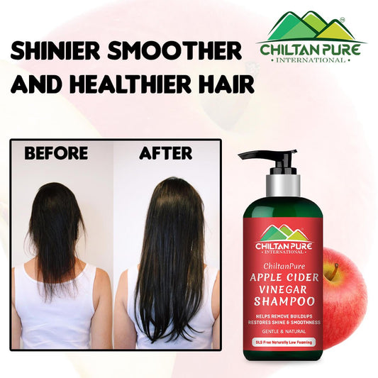 Apple Cider Vinegar Shampoo – Enhance Hair Shine, Balance PH Level of Hair, Promote Hair Growth & Strengthen Hair Follicles 250ml - ChiltanPure