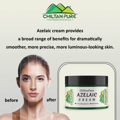 Azelaic Cream – Antibacterial, Lighten Freckles, Reduce Hyperpigmentation & Fade Acne Scars 50ml - Mamasjan