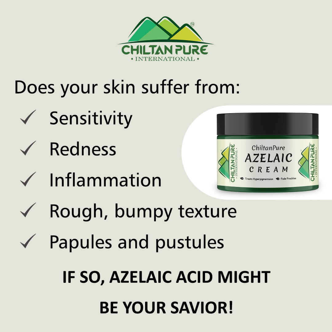 Azelaic Cream – Antibacterial, Lighten Freckles, Reduce Hyperpigmentation & Fade Acne Scars 50ml - Mamasjan