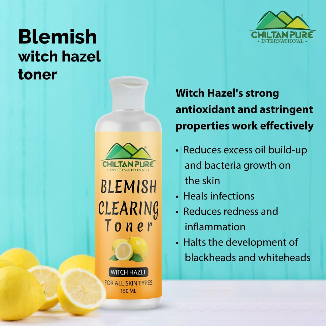 Blemish Clearing Toner – Soothes Redness & Inflammation, Fights with Acne & Helps Prevent Breakouts, Good For All Skin Types - Mamasjan