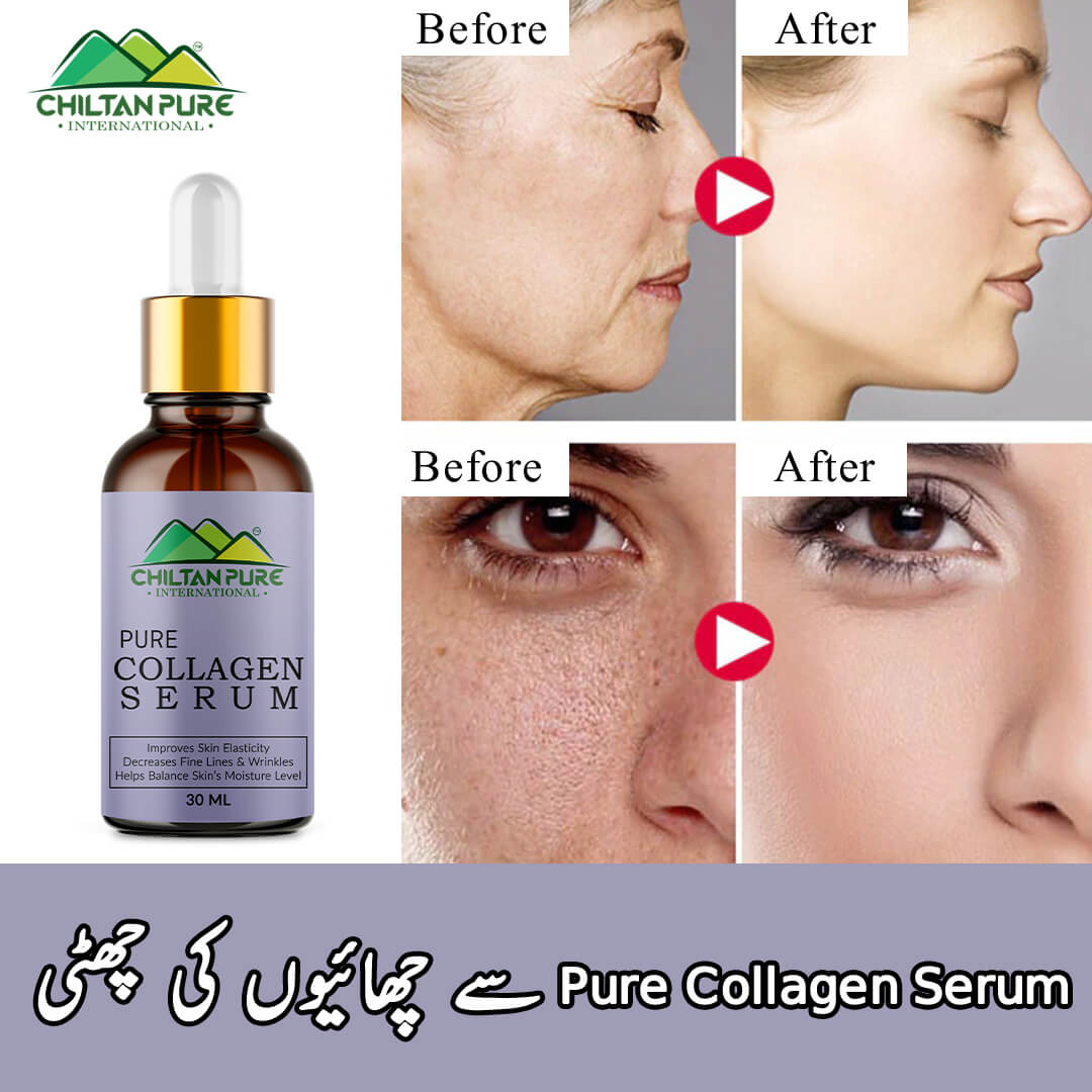 Collagen Serum – Fades Wrinkles, Skin Tightening & Makes Skin Smoother - Mamasjan