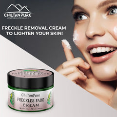 Freckles Fade Cream – Hydrates Skin, Fade Freckles, Reduce Blemishes & Lightens Hyperpigmentation