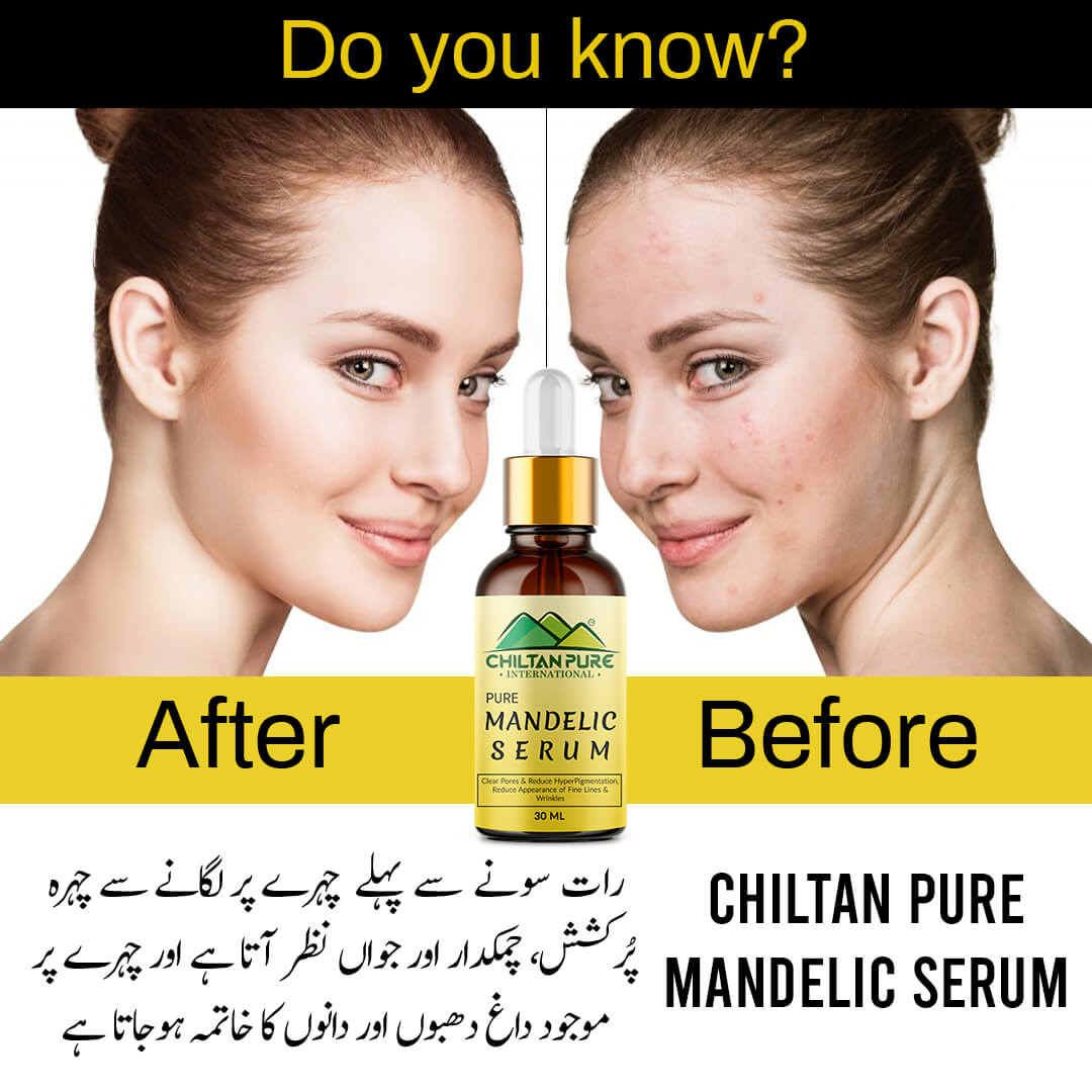 Mandelic Serum - Get Brighter &amp; Luminous Complexion - Mamasjan