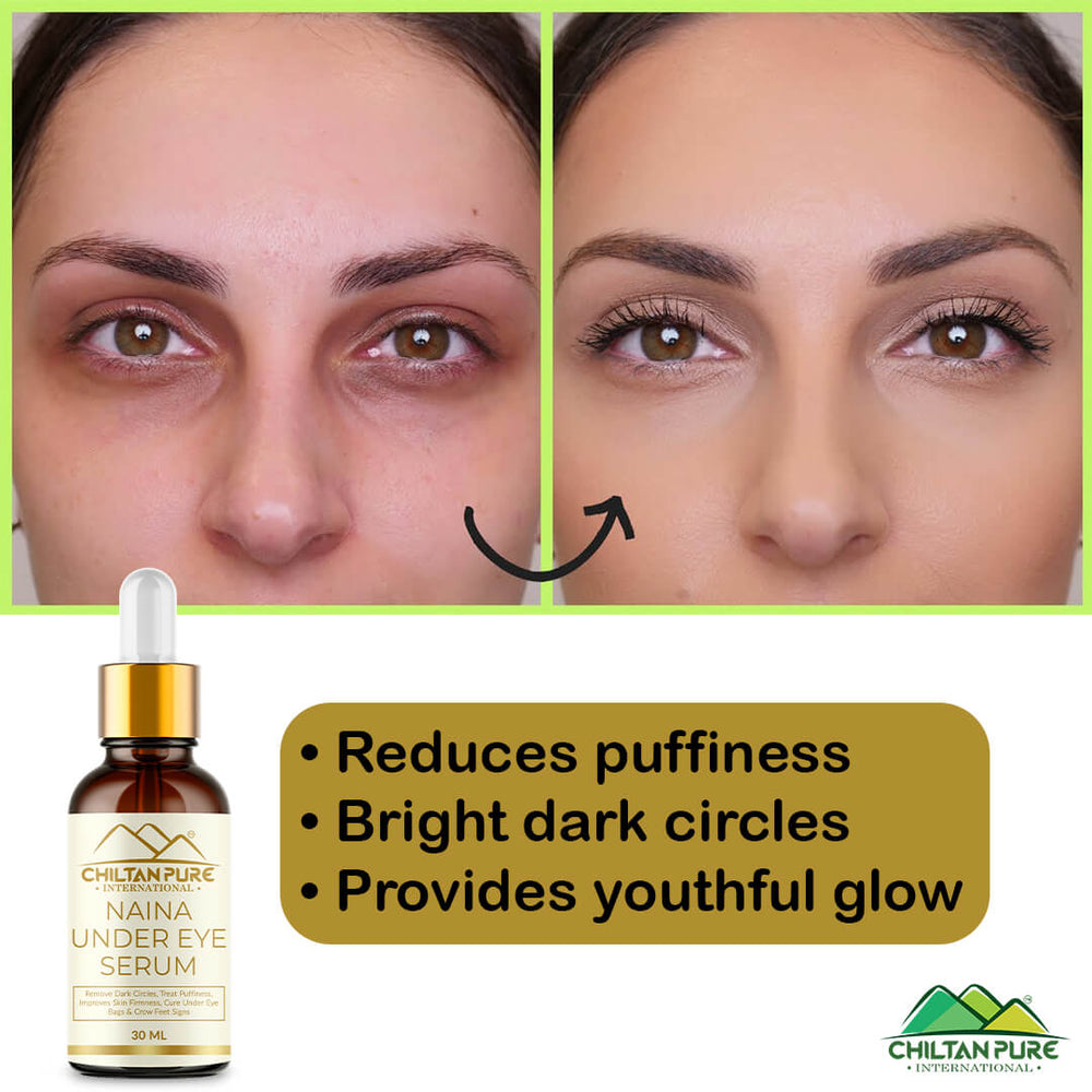 Naina Under Eye Serum – For Firm Delicate Skin, Support firm refreshed look – Reduce fine lines, Dark circles & Puffiness (100% result) - Mamasjan