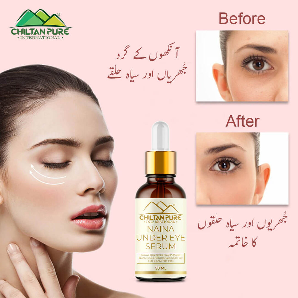 Naina Under Eye Serum – For Firm Delicate Skin, Support firm refreshed look – Reduce fine lines, Dark circles & Puffiness (100% result) - Mamasjan