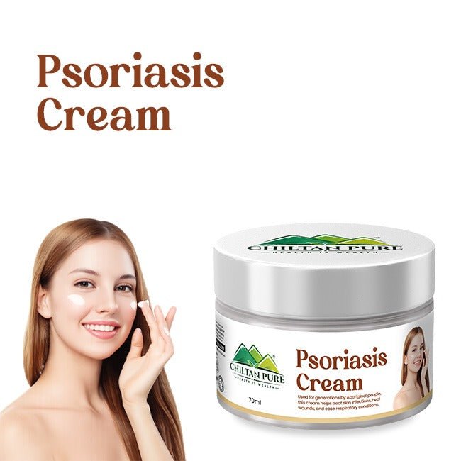 Psoriasis Cream / سورائسس کریم - ChiltanPure