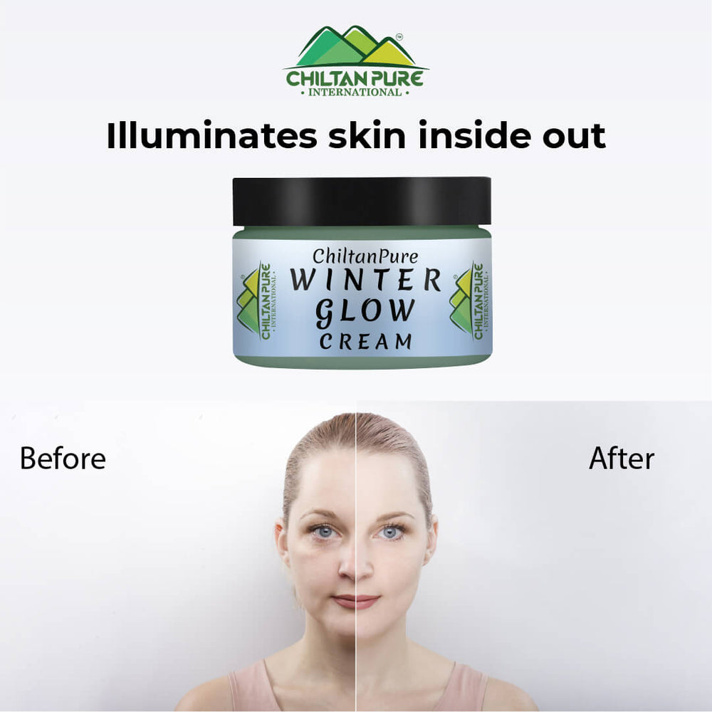 Winter Glow Cream – Formulated With Multivitamins & Moisturizers, Makes Skin Soft & Supple, Good For Dry & Dehydrated Skin - Mamasjan