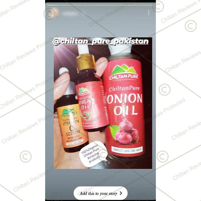 Red Onion Oil 🧅 Reduces Hair Fall &amp; Accelerates Hair Regrowth [پیاز کا تیل].. Trending.... 🔥 - Mamasjan